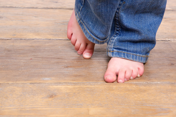 Piedi spellati nei bambini, ecco i rimedi naturali