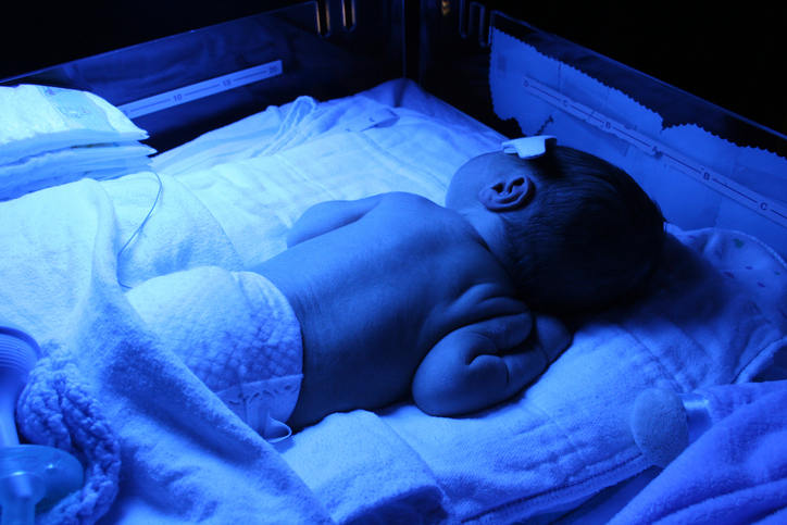 Fototerapia neonatale: effetti collaterali, durata e indicazioni