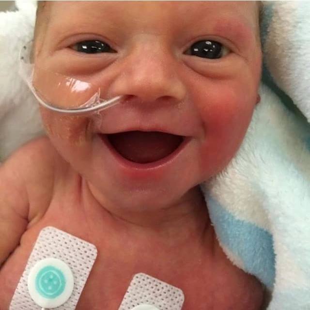 Il sorriso della neonata prematura ha conquistato tutti