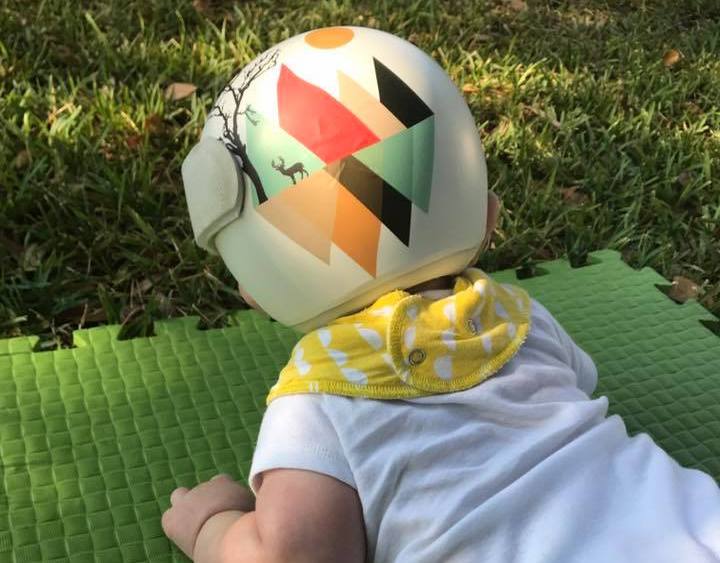 La famiglia di Jonas, bimbo affetto da plagiocefalia, indossa il casco per solidarietà