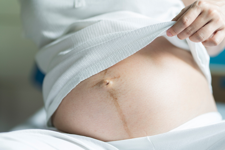 Come cambia l'ombelico durante la gravidanza?